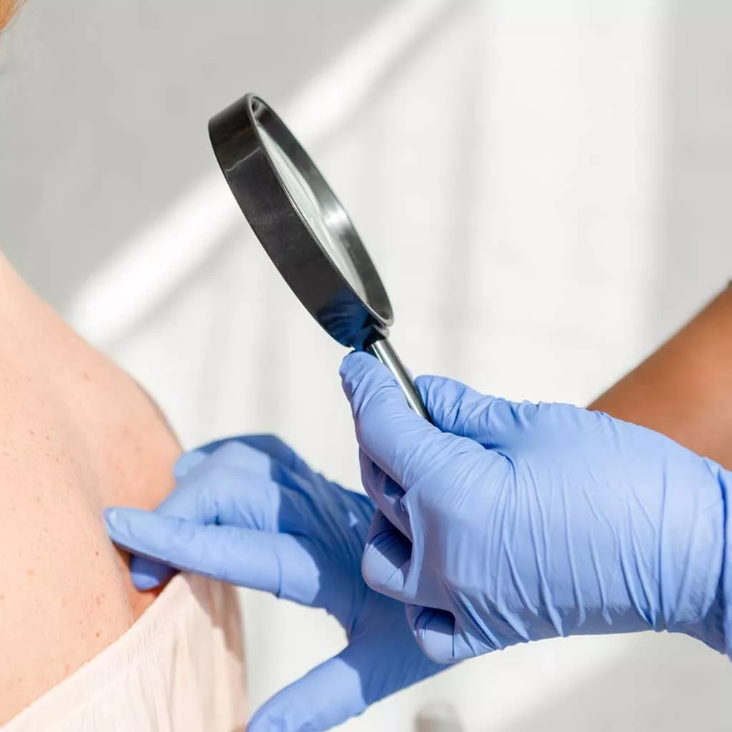 tattoo removal near me