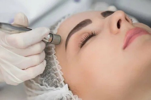 best treatment for melasma on face​