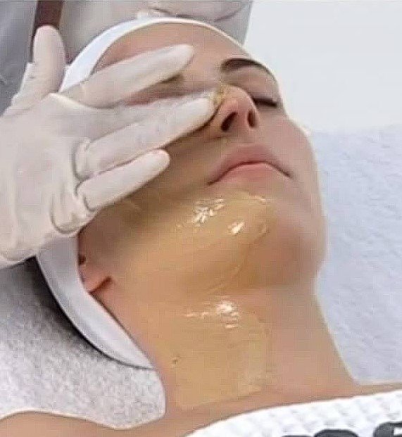 skin whitening treatment